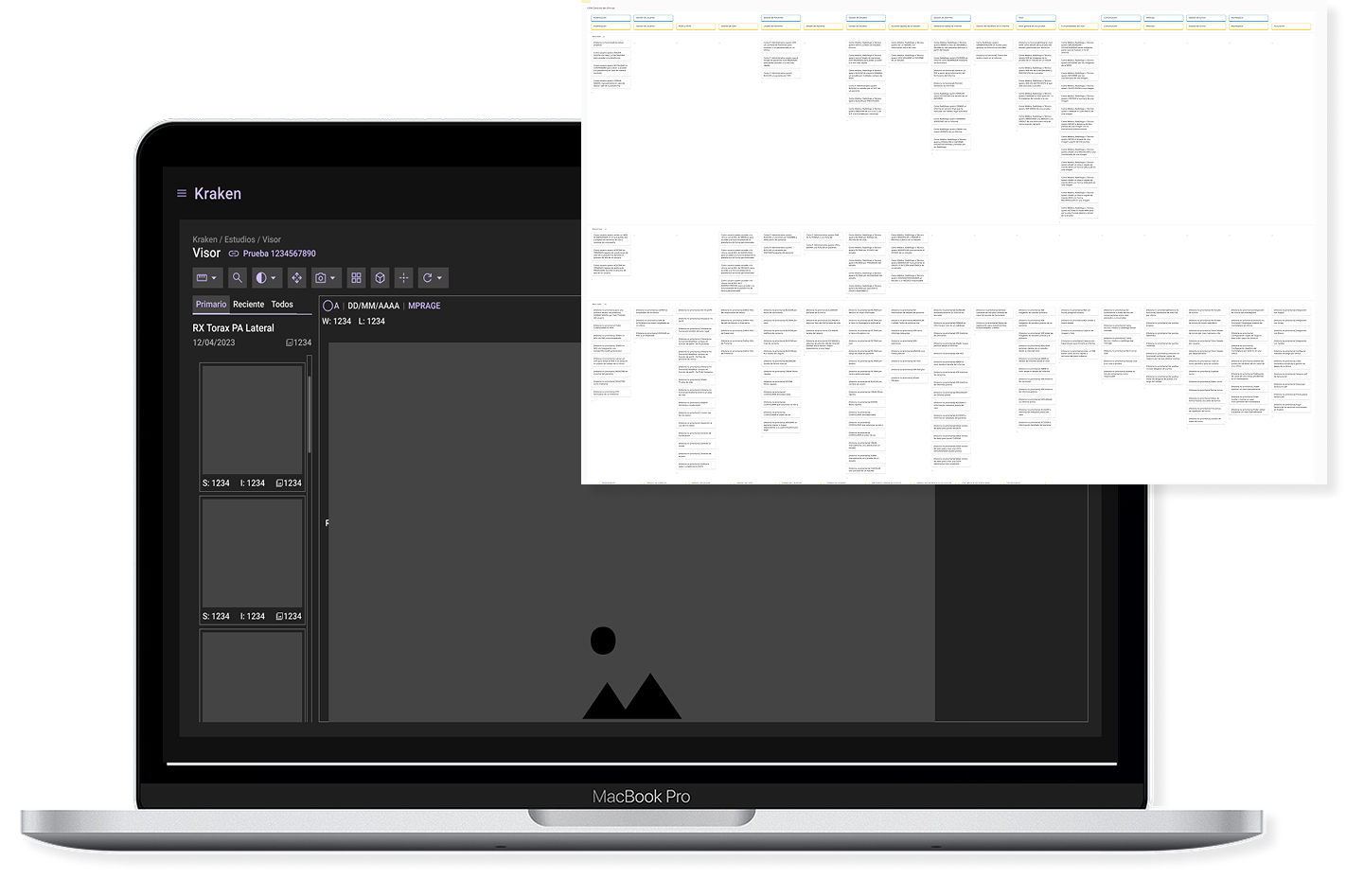 imagen de prototipo del proyecto en el que se ven los wireframes y el backlog