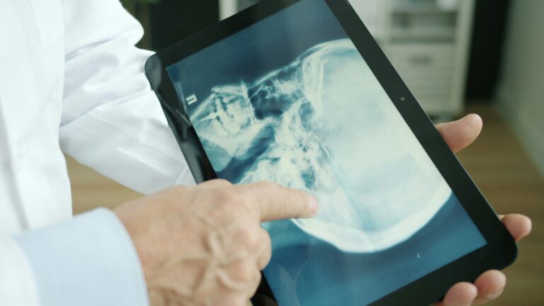 Análisis funcional para radiología